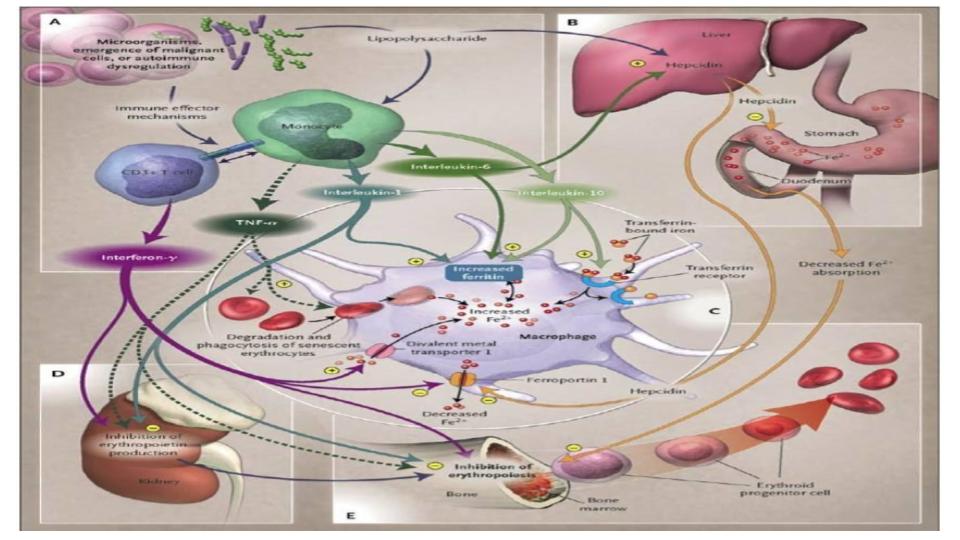 Iron Toxicity Post #56: How Anemia of Inflammation is misdiagnosed ...